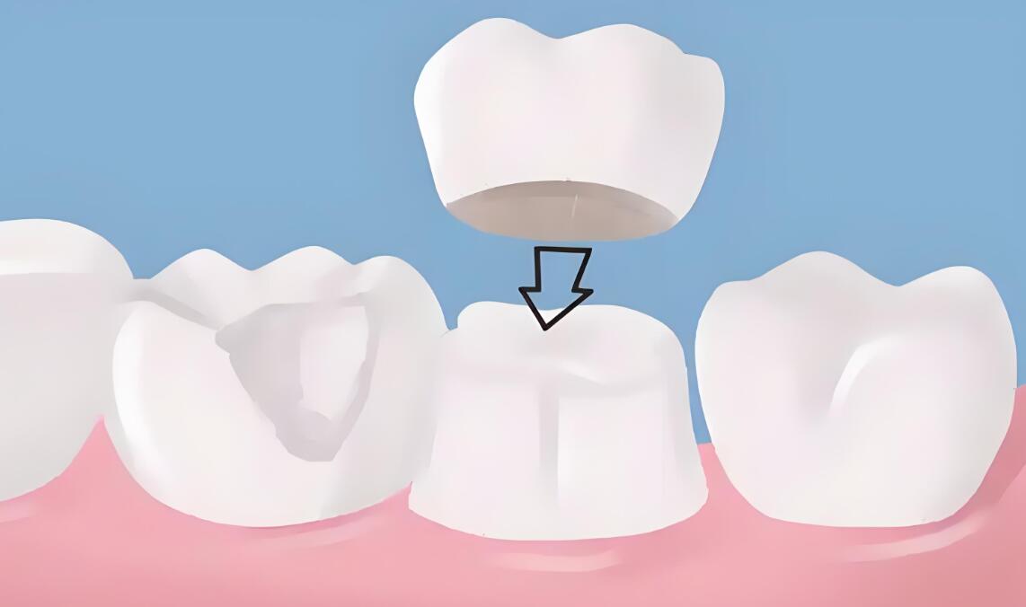 83621a9ff0e14010d17883c4cdb1ff84_9e940c4fb414ece818a49c70493935eb 83621a9ff0e14010d17883c4cdb1ff84_9e940c4fb414ece818a49c70493935eb