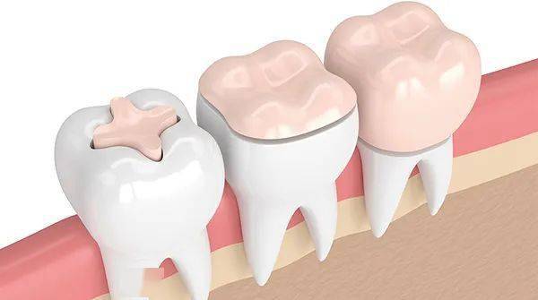 bad6038804114d51018ade76f943d6b0_d5dd5836835d4fbeb75aacfc43f78db7