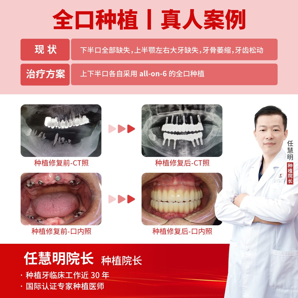 f2339f1b2463fa238fa1e383d785ae5.jpg f2339f1b2463fa238fa1e383d785ae5.jpg